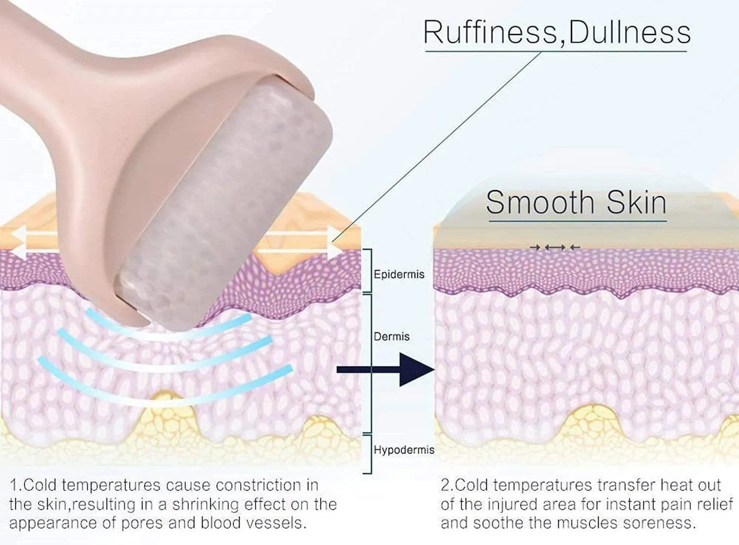 Accuderma™