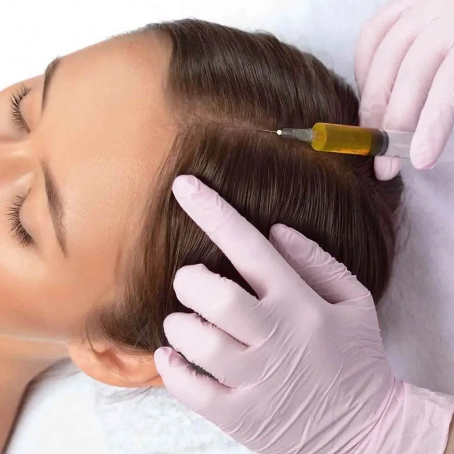 PRP Hair/Scalp Treatment